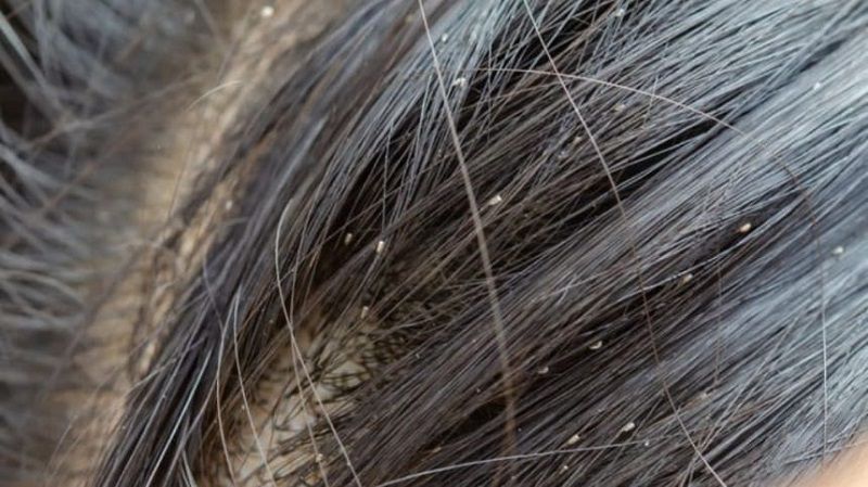 Giải đáp một số thắc mắc thường gặp (FAQ)